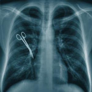 X-ray of scissors forgotten | Medical Malpractice Lawyers | Long Island, NY 
